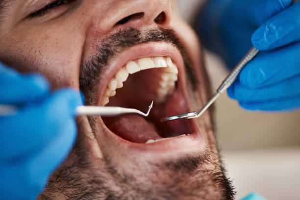 Best Weekend Emergency Dentist in Camp Barrett, VA