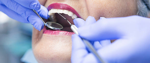 Best Broken or Cracked Tooth Emergency Dentist in Camp Barrett, VA